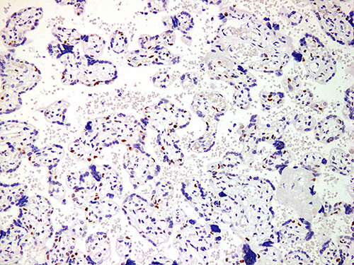 p57 Monoclonal Antibody (ELAB6206-M)