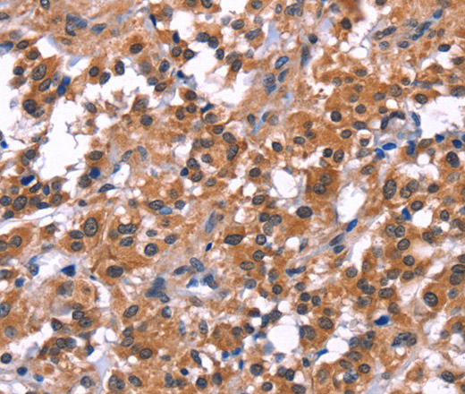 PIP5K1B Polyclonal Antibody (E-AB-10952)