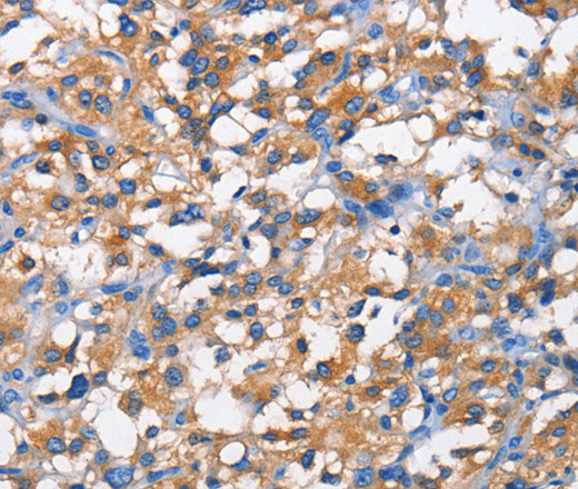 PFKP Polyclonal Antibody (E-AB-14704)