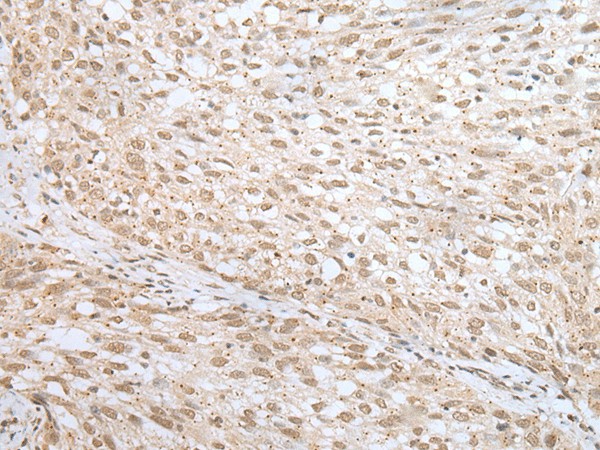 MORF4L1 Polyclonal Antibody (E-AB-53393)