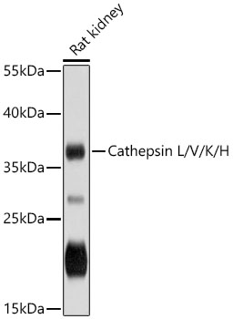 Cathepsin L/V/K/H Polyclonal Antibody (E-AB-90370)