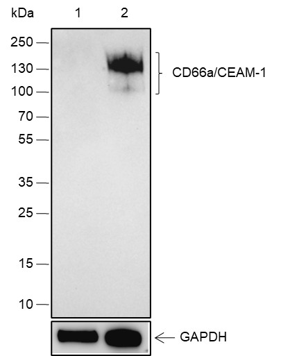 Recombinant CEACAM1 Monoclonal Antibody (AN301418L)