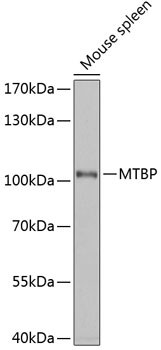 MTBP Polyclonal Antibody (E-AB-65898)