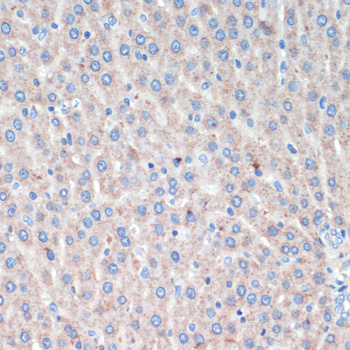 LRRK2 Polyclonal Antibody (E-AB-67089)