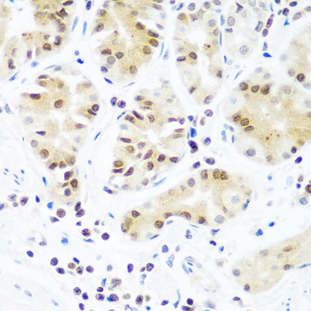 Argonaute-2 Polyclonal Antibody (E-AB-63835)