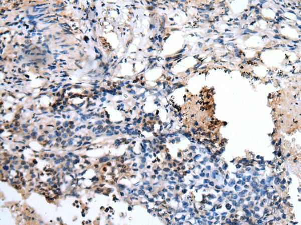 PPP1R15A Polyclonal Antibody (E-AB-19394)