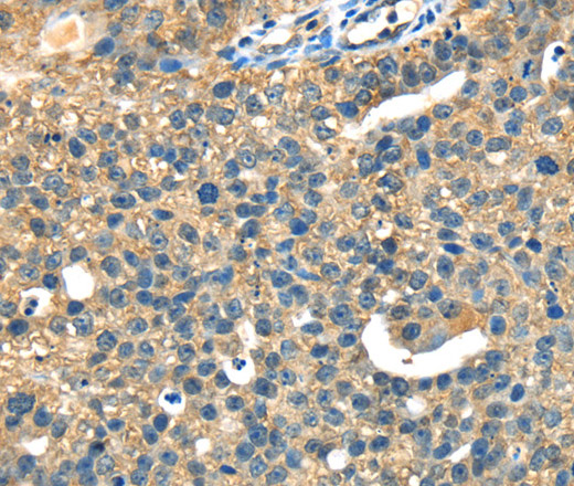 DHCR24 Polyclonal Antibody (E-AB-15380)