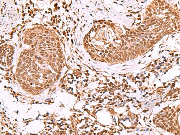 IP6K1 Polyclonal Antibody (E-AB-52037)