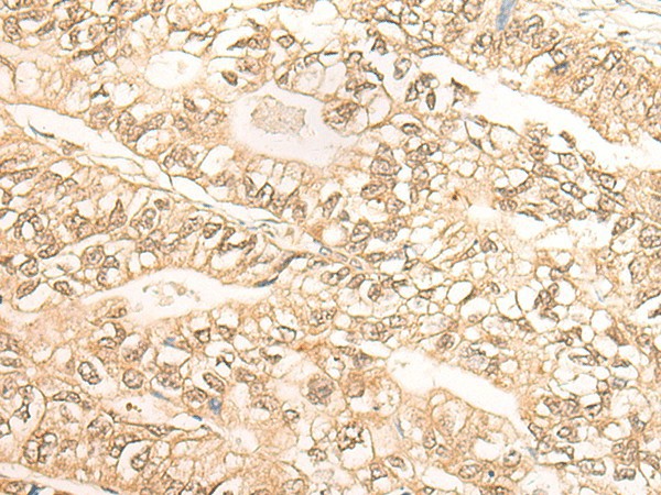 DMC1 Polyclonal Antibody (E-AB-18627)