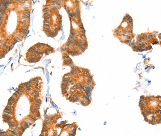 ACOX1 Polyclonal Antibody (E-AB-14479)