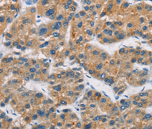 CERK Polyclonal Antibody (E-AB-10955)