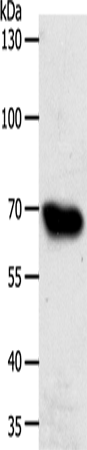 ABCG1 Polyclonal Antibody (E-AB-12687)
