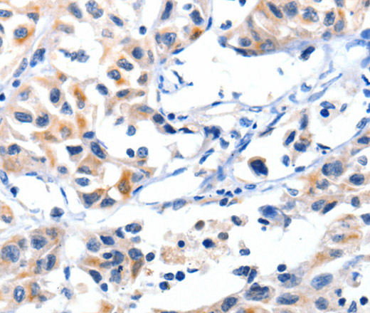 Fibulin 5 Polyclonal Antibody (E-AB-12408)