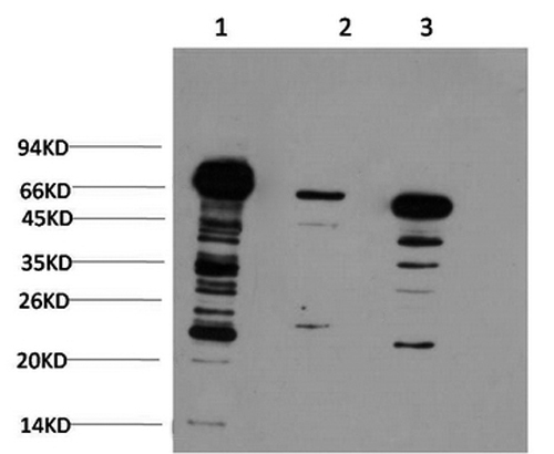 Ubiquitin Monoclonal Antibody (E-AB-22131)