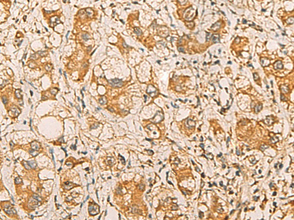 MRPL9 Polyclonal Antibody (E-AB-19209)