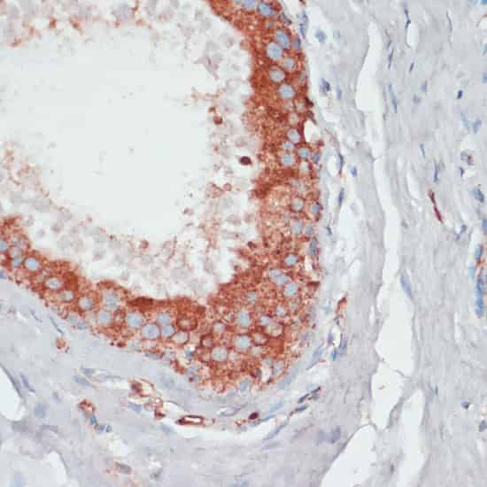 PGK2 Polyclonal Antibody (E-AB-64396)