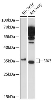 SIX3 Polyclonal Antibody (E-AB-91776)