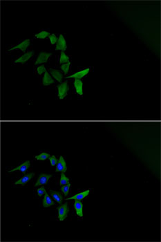 MAVS Polyclonal Antibody (E-AB-61105)