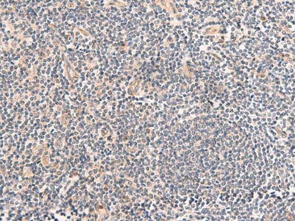 TEAD3 Polyclonal Antibody (E-AB-52887)