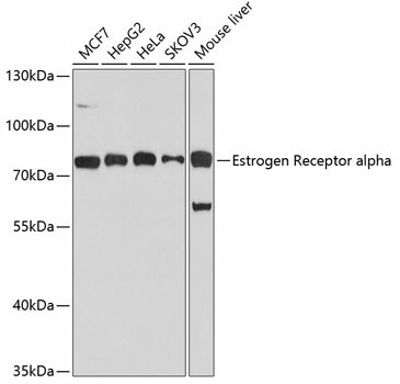 Estrogen Receptor alpha Polyclonal Antibody (E-AB-60073)