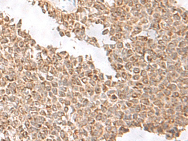 USP16 Polyclonal Antibody (E-AB-19831)