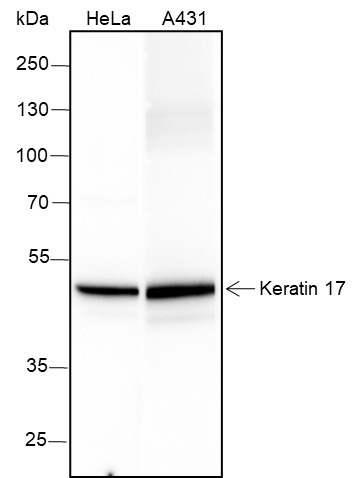 Recombinant Keratin 17 Monoclonal Antibody (AN301576L)