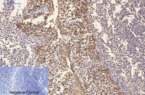 CK-16 Monoclonal Antibody (E-AB-22019)