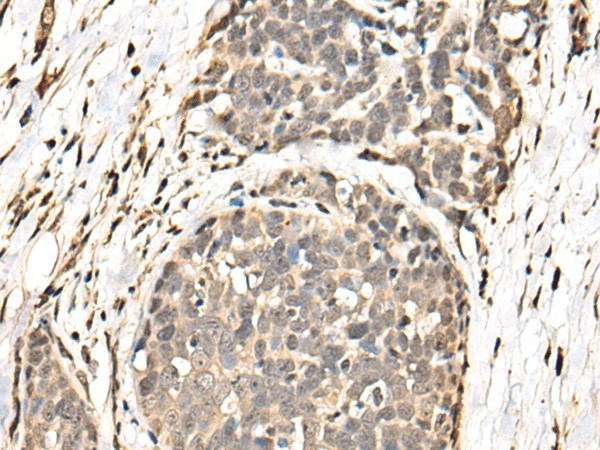 BATF Polyclonal Antibody (E-AB-52464)