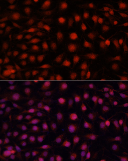 eNOS Polyclonal Antibody (E-AB-66416)
