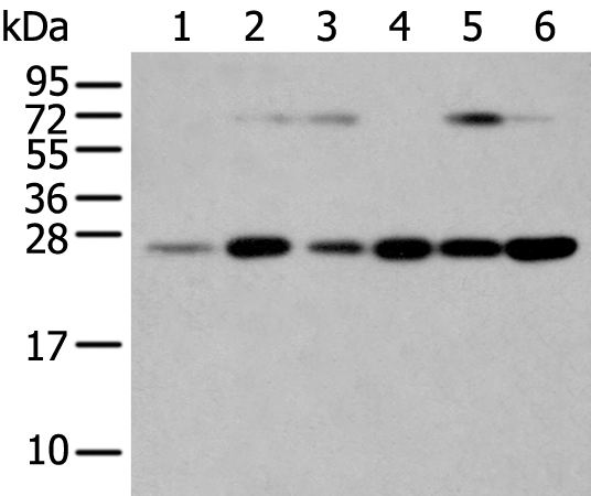 SNAP23 Polyclonal Antibody (E-AB-11592)