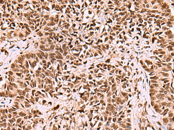 LDB1 Polyclonal Antibody (E-AB-19008)