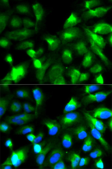 SNAP25 Polyclonal Antibody (E-AB-60128)