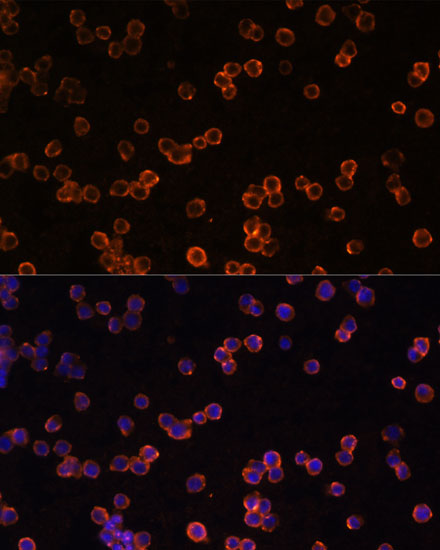 ENTPD1/CD39 Polyclonal Antibody (E-AB-63756)