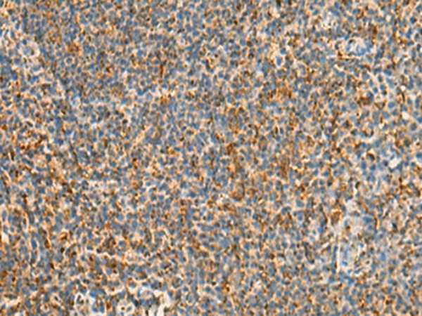 STK32C Polyclonal Antibody (E-AB-18822)