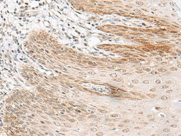 RALGAPA1 Polyclonal Antibody (E-AB-19896)