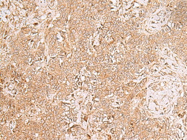 GMPPB Polyclonal Antibody (E-AB-18998)