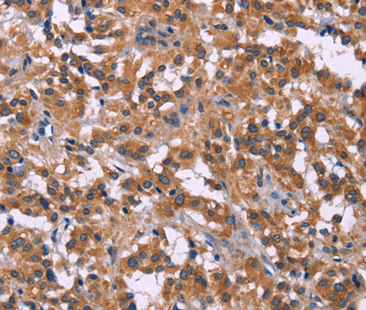 PIP5K1B Polyclonal Antibody (E-AB-14738)