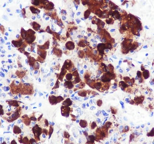 Recombinant ACTH Monoclonal Antibody (AN301965L)