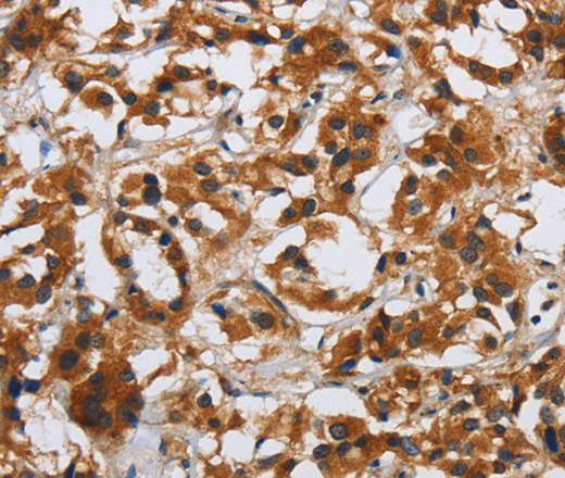DSP Polyclonal Antibody (E-AB-12373)