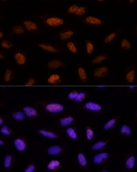 ADNP Polyclonal Antibody (E-AB-65484)
