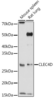 CLEC4D Polyclonal Antibody (E-AB-92487)