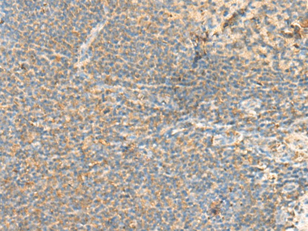 RHOH Polyclonal Antibody (E-AB-18792)