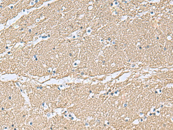 TAGLN3 Polyclonal Antibody (E-AB-19160)