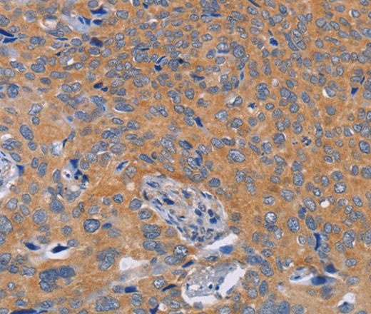 BOD1 Polyclonal Antibody (E-AB-16283)