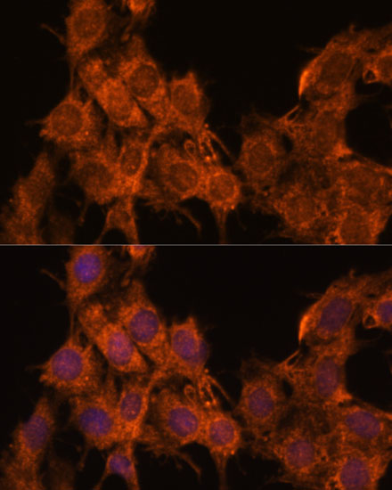 SNX15 Polyclonal Antibody (E-AB-65611)