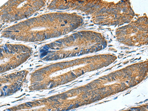 HSD11B1 Polyclonal Antibody (E-AB-52192)