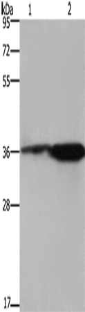 CD89 Polyclonal Antibody (E-AB-15027)