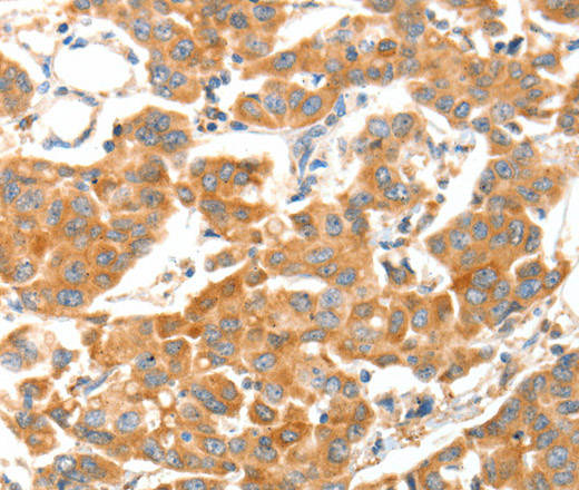 ADAMTS18 Polyclonal Antibody (E-AB-14506)