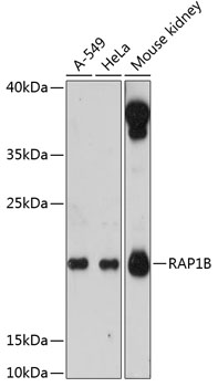 RAP1B Polyclonal Antibody (E-AB-64378)