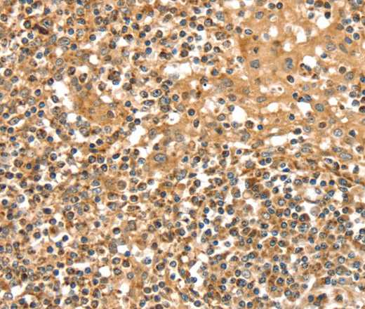 SLC8A3 Polyclonal Antibody (E-AB-13657)
